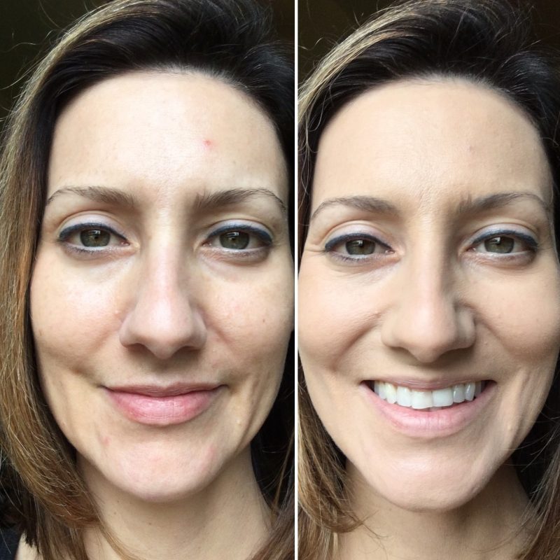 bye-bye-redness