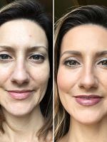 with-bye-bye-redness